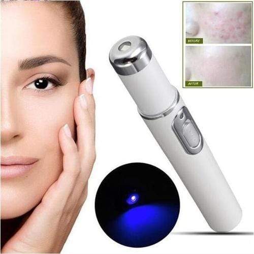 Therapeutic Laser Pen for Varicose Veins